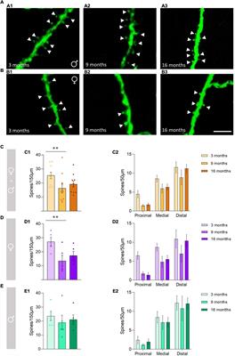 Effects of Aging on the Structure and Expression of NMDA Receptors of Somatostatin Expressing Neurons in the Mouse Hippocampus